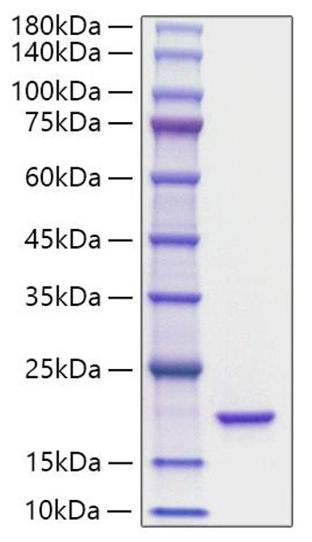 Recombinant Mouse IL-36Ra/IL-1F5 Protein (RPCB1101)