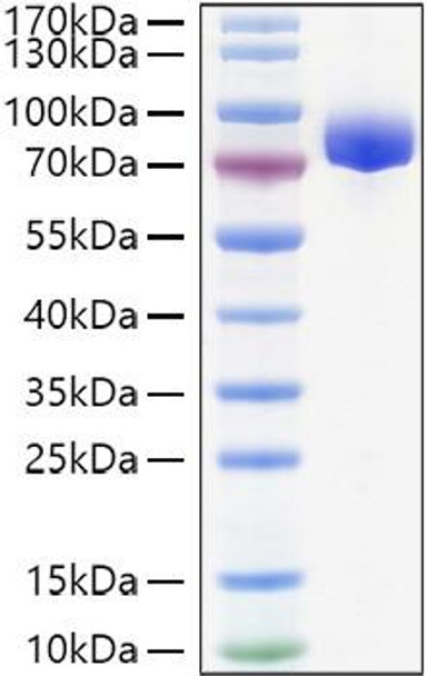Recombinant Human APLP-1 Protein (RPCB1113)