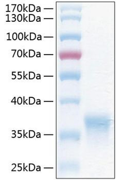Recombinant Human HCVADR/CXADR Protein (RPCB1117)