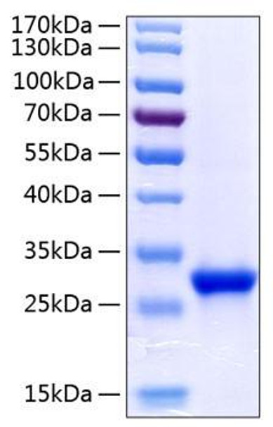 Recombinant Human Tetranectin/CLEC3B Protein (RPCB1120)