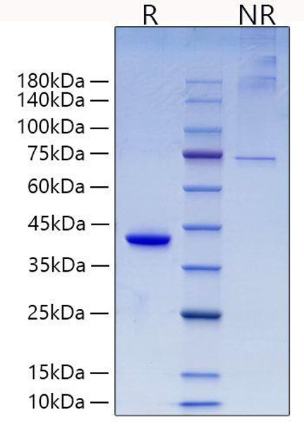 Recombinant Mouse RETN Protein (RPCB1124)
