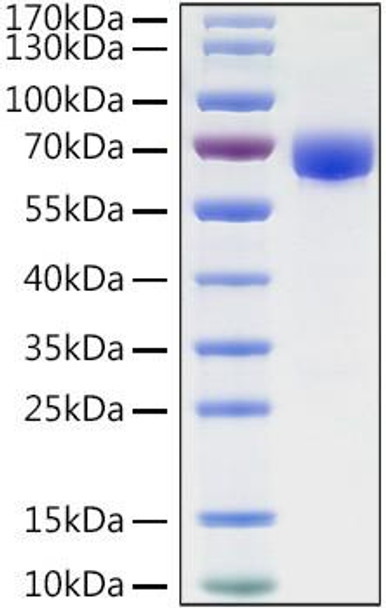 Recombinant Human B7-H3/CD276 Protein (RPCB1128)