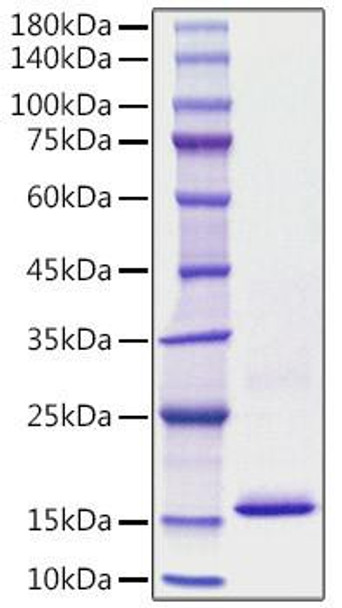 Recombinant Human S100-A8 Protein (RPCB1141)