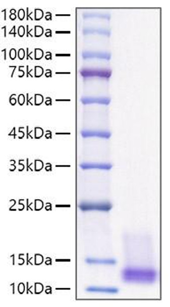Recombinant Human IGF-I Protein (RPCB1177)