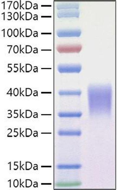 Recombinant Mouse Ephrin-B2/EFNB2 Protein (RPCB1184)
