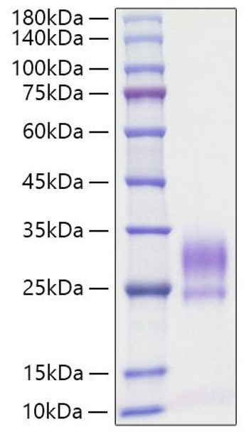 Recombinant Rat IL-3 Protein (RPCB1205) Recombinant Rat IL-3 Protein (RPCB1205)
