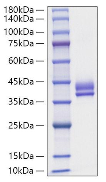 Recombinant Human Gastric inhibitory polypeptide/GIP Protein (RPCB1211) Recombinant Human Gastric inhibitory polypeptide/GIP Protein (RPCB1211)