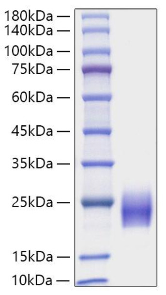 Recombinant Human FSH Beta Protein (RPCB1213)