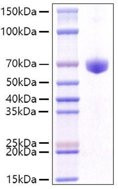 Recombinant Mouse CD8a Protein (RPCB1250)