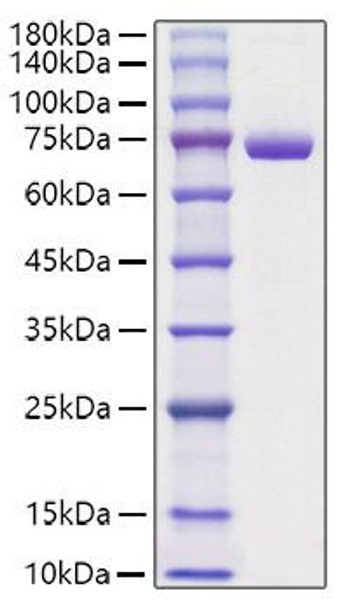 Recombinant Mouse Periostin/PN/POSTN Protein (RPCB1251)
