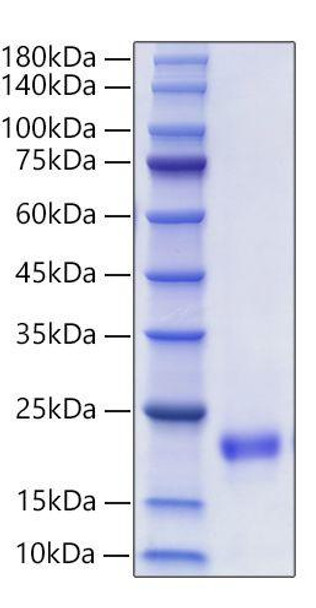 Recombinant Mouse VEGF-D/FIGF Protein (RPCB1252)