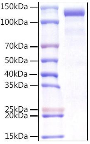 Recombinant Human CDCP1/gp140/CD318 Protein (RPCB1264)