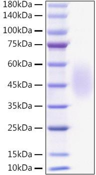 Recombinant Mouse B7-H2/ICOSLG/CD275 Protein (RPCB1273)