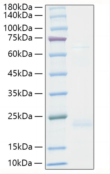 Recombinant Human TNF-beta Protein (RPCB1298) Recombinant Human TNF-beta Protein (RPCB1298)