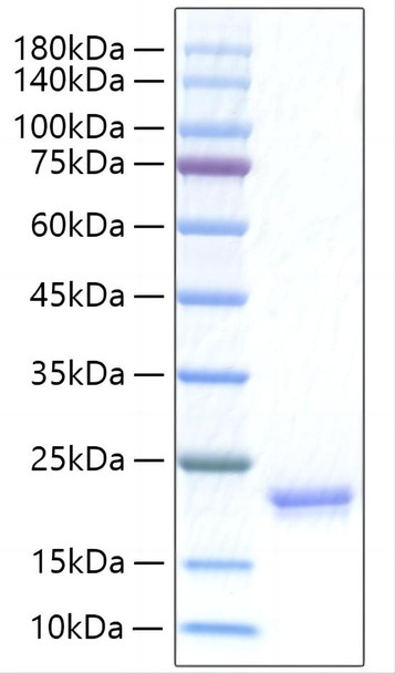 Recombinant Human IFN-alpha I/IFN17 Protein (RPCB1320)
