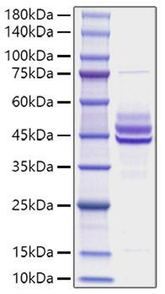 Recombinant Mouse IL-12B/IL-12 p40 Protein (RPCB1326)