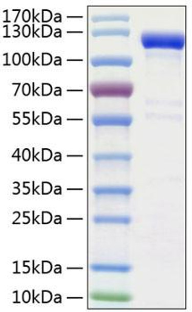 Recombinant Human Semaphorin-4A/SEMA4A Protein (RPCB1338)