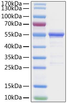 Recombinant SARS-CoV-2 Nucleocapsid(G335A) Protein (RPCB1358)