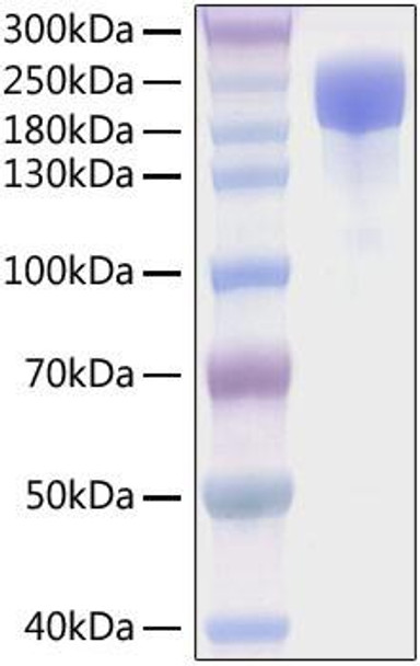 Recombinant SARS-CoV-2 Spike S1+S2 ECD(S-ECD)(D614G)  Protein (RPCB1359)