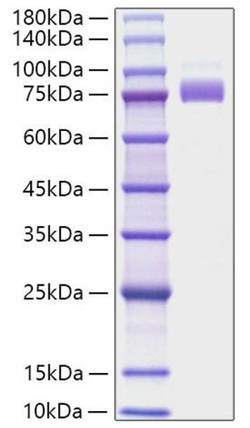 Recombinant Human Siglec-10 Protein (RPCB1360)