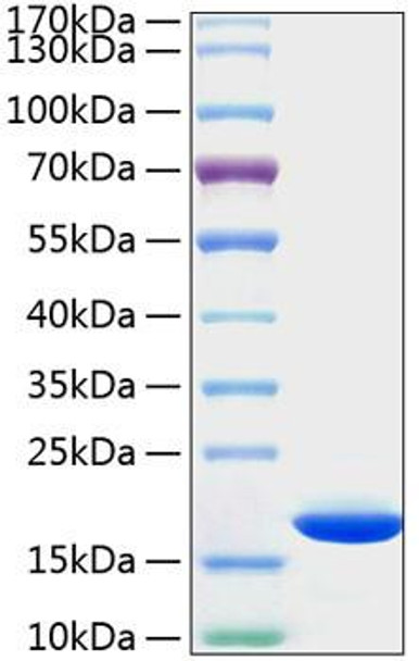 Recombinant Human Cyclophilin B/PPIase B/PPIB Protein (RPCB1368)