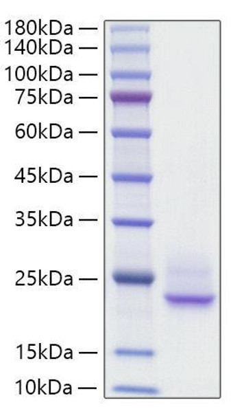 Recombinant Rat IFNA1 Protein (RPCB1373)