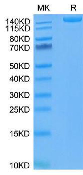 Recombinant SARS-COV-2 Spike S1+S2 ECD(S-ECD)(D614G) Trimer Protein (RPCB1381)
