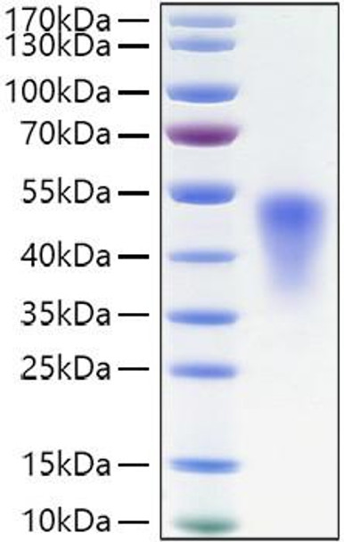 Recombinant Mouse TNFRSF1B/TNF-R2/CD120b Protein (RPCB1391)