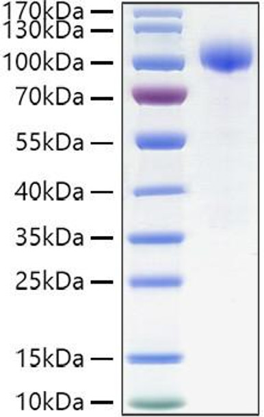 Recombinant Human IL-23R Protein (RPCB1395)
