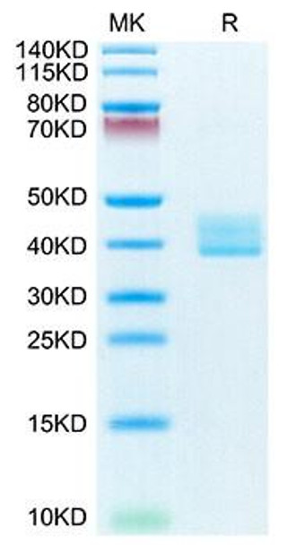 Recombinant Mouse TNFRSF17/BCMA/CD269 Protein (RPCB1406)