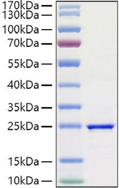 Recombinant Human FGF-3 Protein (RPCB1416)