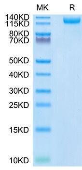 Recombinant SARS-COV-2 Spike S1 (N501Y) Protein (RPCB1427)