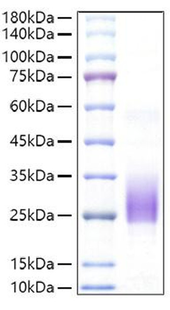Recombinant Mouse BY55/CD160 Protein (RPCB1460)
