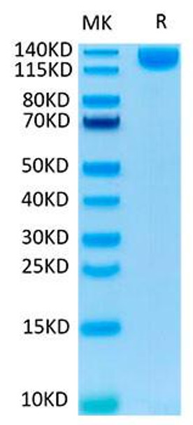 Recombinant SARS-COV-2 Spike S1 Protein (RPCB1479)