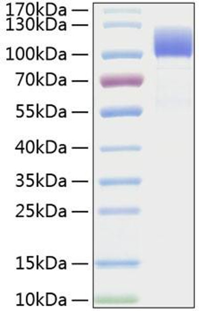 Recombinant Human CD6 Protein (RPCB1488)