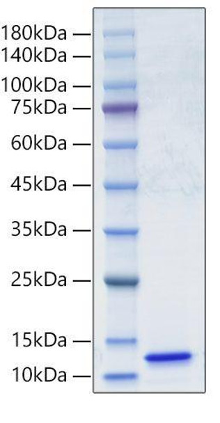 Recombinant Human Complement C5A Protein (RPCB1494)