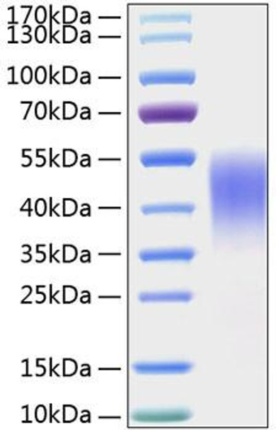 Recombinant Mouse TIM-3/HAVCR2/CD366 Protein (RPCB1501)