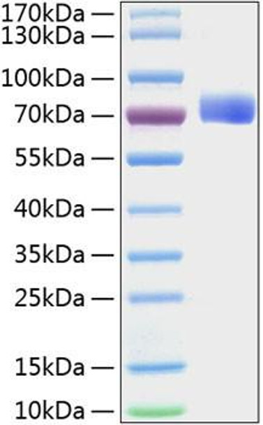 Recombinant Mouse EphB2 Protein (RPCB1503)