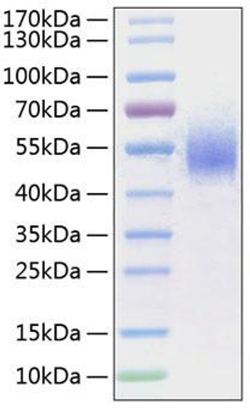 Recombinant Human Fc gamma RI/FCGR1/CD64 Protein (RPCB1509) Recombinant Human Fc gamma RI/FCGR1/CD64 Protein (RPCB1509)