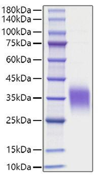 Recombinant Human IL-9 Protein (RPCB1513) Recombinant Human IL-9 Protein (RPCB1513)