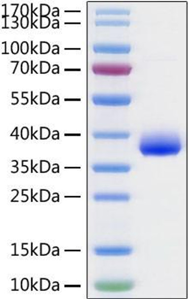 Recombinant SARS-CoV-2 Spike RBD  Protein (RPCB1515)