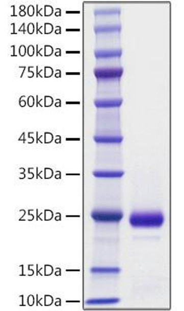Recombinant Mouse IFN-alpha 2 Protein (RPCB1521)