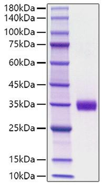 Recombinant Mouse Angiopoietin-2/ANG-2/ANGPT2(275-496) Protein (RPCB1524)