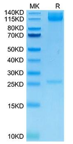 Recombinant Human Integrin alpha 5 beta 1 (ITGA5&ITGB1) Heterodimer Protein (RPCB1530)