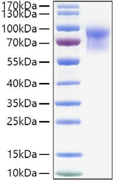 Recombinant Mouse IL-15RA/CD215 Protein (RPCB1545)