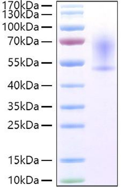 Recombinant Mouse CX3CL1/Fractalkine Protein (RPCB1546)