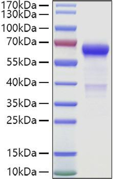 Recombinant Human VSIG3/IgSF11 Protein (RPCB1551) Recombinant Human VSIG3/IgSF11 Protein (RPCB1551)