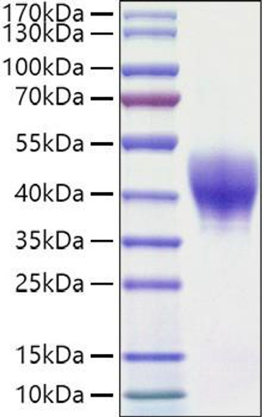 Recombinant Mouse TROP-2/TACSTD2 Protein (RPCB1559)