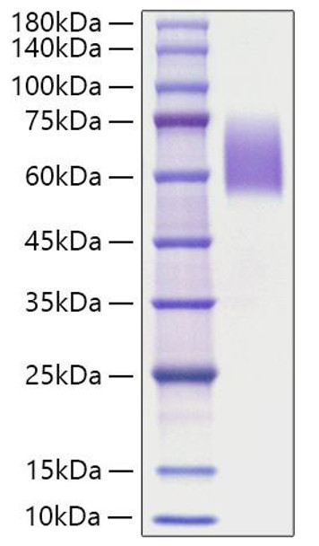 Recombinant Human Microtubule-associated protein tau/MAPT Protein (RPCB1574)
