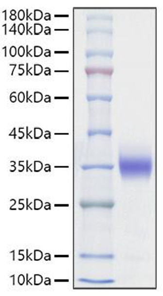Recombinant Rat Sclerostin/SOST Protein (RPCB1624)